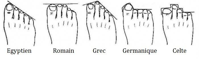 Infographie des différents types de pieds